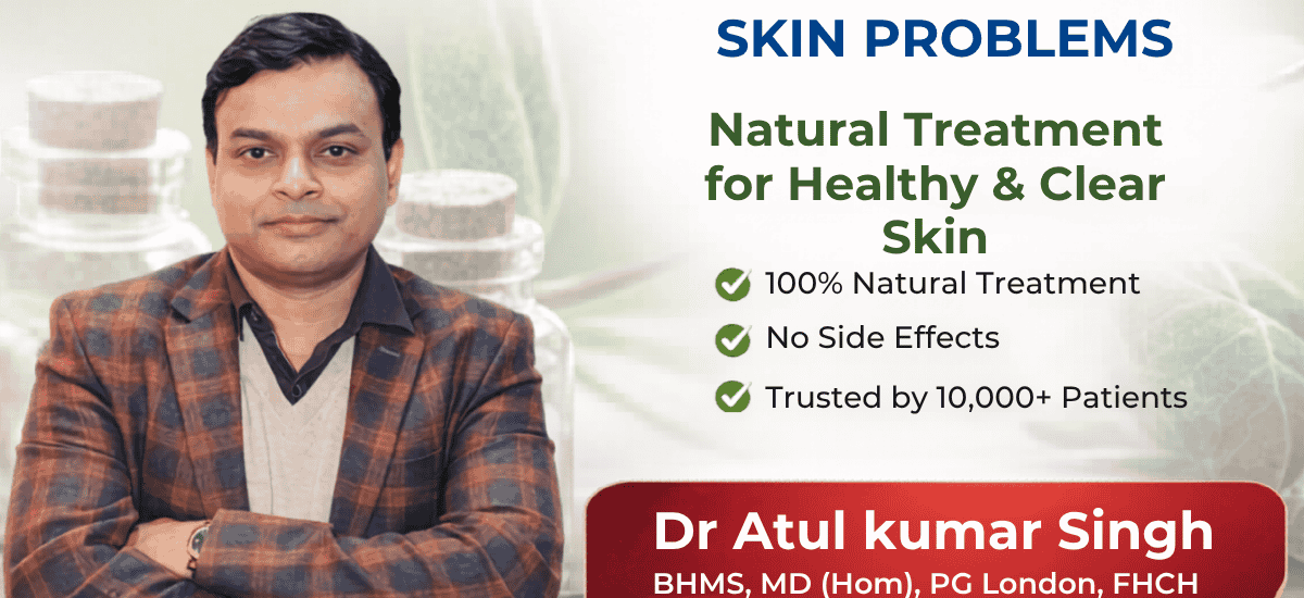 Homeopathy for Skin Problems | Natural Treatment for Healthy & Clear Skin